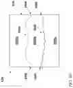 Fig. 11 - Wearable audio device with capacitive touch interface