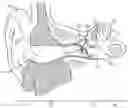 Fig. 01 - HEARING SYSTEM HAVING IMPROVED HIGH FREQUENCY RESPONSE