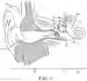 Fig. 02 - HEARING SYSTEM HAVING IMPROVED HIGH FREQUENCY RESPONSE