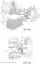 Fig. 04 - HEARING SYSTEM HAVING IMPROVED HIGH FREQUENCY RESPONSE