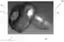 Fig. 01 - Hearing Protection Device and Method