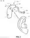 Fig. 03 - Listening device with automatic mode change capabilities