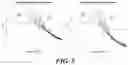 Fig. 04 - Audio signal processing method and device
