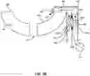 Fig. 08 - System, method and apparatus for target material debris cleaning of EUV vessel and EUV collector