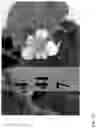 Fig. 22 - Strawberry cultivars