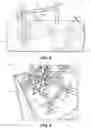 Fig. 04 - Hydraulically actuated litter level