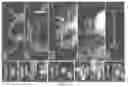 Fig. 05 - Genetic system for promoting recombination and gene transfer in wheat