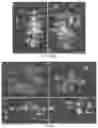 Fig. 08 - Genetic system for promoting recombination and gene transfer in wheat
