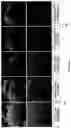 Fig. 05 - METHODS OF A DROSOPHILA MODEL FOR CHRONIC MYELOID LEUKEMIA (CML) TREATMENT