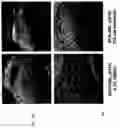 Fig. 07 - METHODS OF A DROSOPHILA MODEL FOR CHRONIC MYELOID LEUKEMIA (CML) TREATMENT