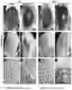 Fig. 18 - METHODS OF A DROSOPHILA MODEL FOR CHRONIC MYELOID LEUKEMIA (CML) TREATMENT