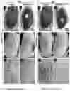 Fig. 19 - METHODS OF A DROSOPHILA MODEL FOR CHRONIC MYELOID LEUKEMIA (CML) TREATMENT
