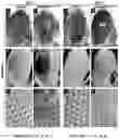 Fig. 20 - METHODS OF A DROSOPHILA MODEL FOR CHRONIC MYELOID LEUKEMIA (CML) TREATMENT