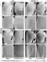 Fig. 24 - METHODS OF A DROSOPHILA MODEL FOR CHRONIC MYELOID LEUKEMIA (CML) TREATMENT