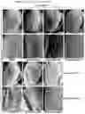Fig. 27 - METHODS OF A DROSOPHILA MODEL FOR CHRONIC MYELOID LEUKEMIA (CML) TREATMENT