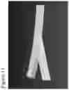 Fig. 12 - Neck strap force distribution
