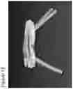 Fig. 16 - Neck strap force distribution