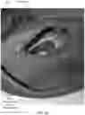 Fig. 17 - HEADGEAR COMPRISING HEADBANDS FOR RECEIVING REMOVABLE LIGHT APPARATUS AND METHODS OF MAKING