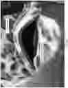 Fig. 29 - HEADGEAR COMPRISING HEADBANDS FOR RECEIVING REMOVABLE LIGHT APPARATUS AND METHODS OF MAKING