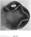 Fig. 34 - HEADGEAR COMPRISING HEADBANDS FOR RECEIVING REMOVABLE LIGHT APPARATUS AND METHODS OF MAKING