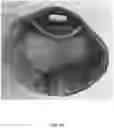Fig. 35 - HEADGEAR COMPRISING HEADBANDS FOR RECEIVING REMOVABLE LIGHT APPARATUS AND METHODS OF MAKING