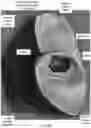 Fig. 45 - HEADGEAR COMPRISING HEADBANDS FOR RECEIVING REMOVABLE LIGHT APPARATUS AND METHODS OF MAKING