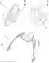 Fig. 13 - Helmet, mounting system for a helmet and method of using same