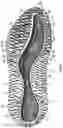 Fig. 04 - Sole structure for an article of footwear with first and second midsole bodies