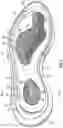 Fig. 07 - Sole structure for an article of footwear with first and second midsole bodies