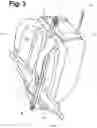 Fig. 04 - Backpack