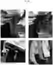 Fig. 33 - STRAPS AND BELTS OF VARIOUS CONFIGURATIONS TO SUPPORT CARRYING TORAH SCROLLS