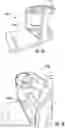 Fig. 17 - Upright surface treatment apparatus having removable pod