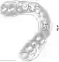 Fig. 10 - Analysis and visualization of a dental arch under a limited accuracy system