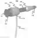 Fig. 01 - SYSTEMS, METHODS AND DEVICES FOR PERFORMING WATER-AIDED ENDOSCOPY