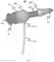 Fig. 02 - SYSTEMS, METHODS AND DEVICES FOR PERFORMING WATER-AIDED ENDOSCOPY