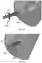 Fig. 12 - SYSTEMS, METHODS AND DEVICES FOR PERFORMING WATER-AIDED ENDOSCOPY