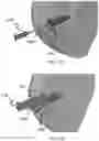 Fig. 13 - SYSTEMS, METHODS AND DEVICES FOR PERFORMING WATER-AIDED ENDOSCOPY