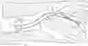 Fig. 01 - Devices for treatment of body lumens