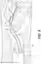 Fig. 05 - Devices for treatment of body lumens
