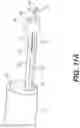 Fig. 10 - Devices for treatment of body lumens