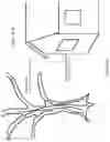 Fig. 71 - Eye imaging in head worn computing