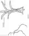 Fig. 72 - Eye imaging in head worn computing