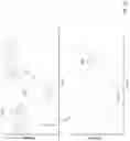 Fig. 14 - BODY-WORN SENSOR FOR CHARACTERIZING PATIENTS WITH HEART FAILURE