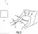 Fig. 03 - Device, system and method for obtaining a vital signal of a subject