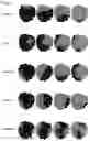 Fig. 08 - Systems and methods for treating cardiac arrhythmia