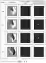 Fig. 07 - Analysis map generating device that analyzes a rotating excitation wave in biological tissue