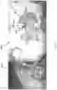 Fig. 07 - Electrocardiogram sensor