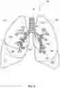 Fig. 04 - SYSTEM AND METHOD FOR LIGHT BASED LUNG VISUALIZATION