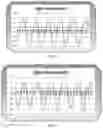 Fig. 08 - Feigned injury detection systems and methods
