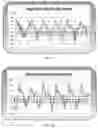 Fig. 10 - Feigned injury detection systems and methods
